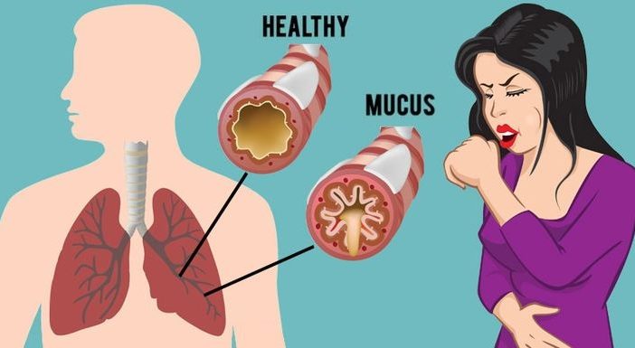 CBD and Mucus Production: Exploring Potential Effects on Respiratory Health